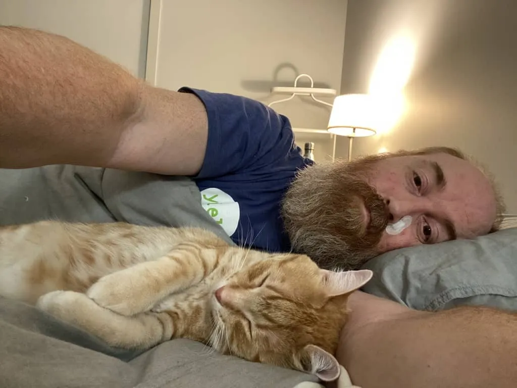 A man with a bandage on his face, cuddling a cat